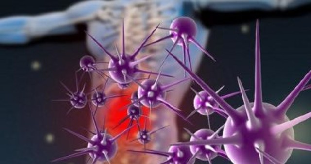 أداة تكشف الإصابة بالسرطان