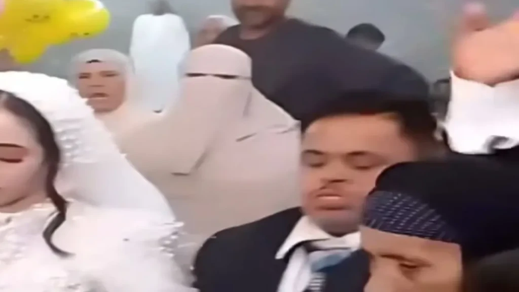 عريس من أصحاب متلازمة داون