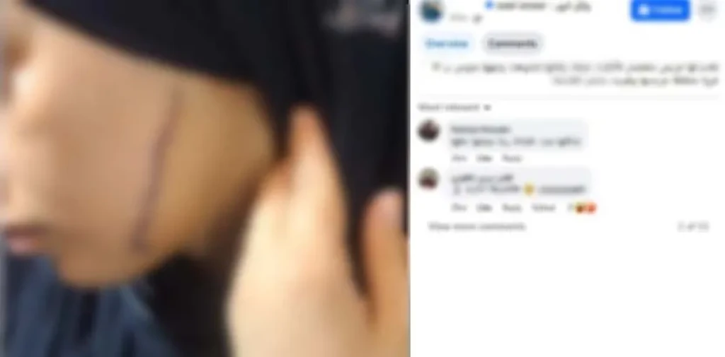 بالصور .. القبض على سيدة قامت بالتعدى علي فتاة بآلة حادة وإصابتها بجرح قطعى بالوجه