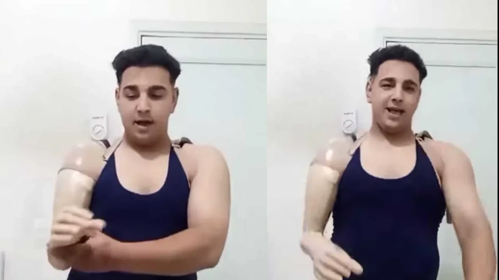 عامل السيرك المصاب بطنطا :”شكرا لمن ساهم في التركيب الطرف الصناعي وعاوز حقي بالقانون