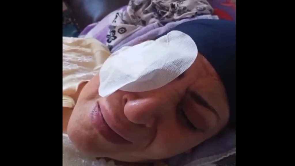 شاهد ..سيدة تستغيث.. عقب إجراؤها عمليه جراحية برمد المحلة بالغربية اصيبت بالعمى باحد عينيها