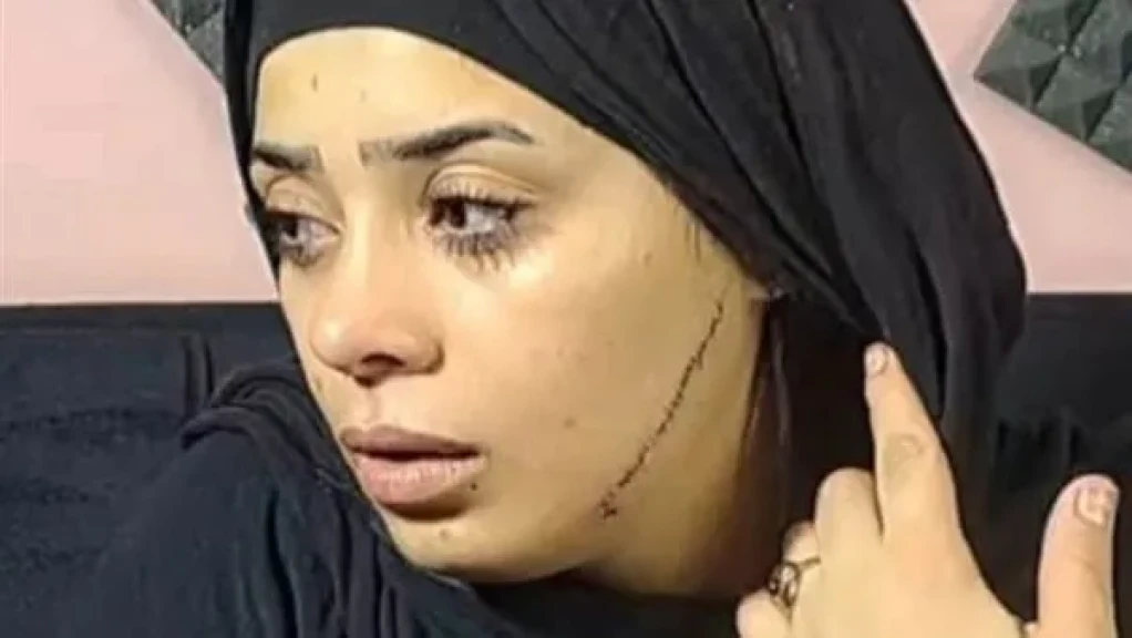 الحبس سنتين للمتهمة بتشويه خطيبة طليقها بمصر القديمة