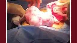 رئيس جامعة طنطا يعلن نجاح...